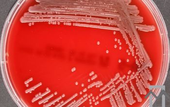 Aeromonas caviae Blood Agar 24h culture incubated with CO2