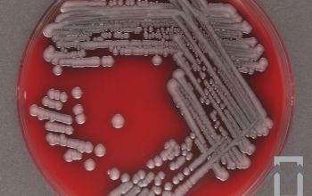 Aeromonas veronii bv. sobria Blood Agar 24h culture incubated with CO2