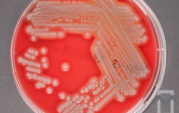 Aeromonas veronii bv. sobria Blood Agar 24h culture incubated with CO2