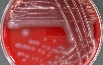 Alcaligenes faecalis Blood Agar 24h culture incubated with CO2