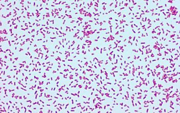 Alcaligenes faecalis Gram stain