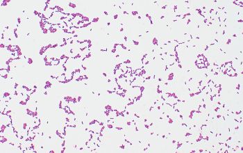 Alloscardovia omnicolens Gram stain