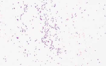 Alloscardovia omnicolens Gram stain