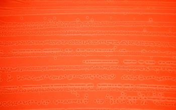 Arcanobacterium haemolyticum Blood Agar 24h culture incubated with CO2