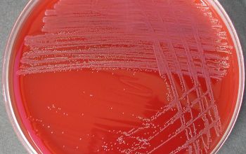 Arcanobacterium haemolyticum Blood Agar 24h culture incubated with CO2