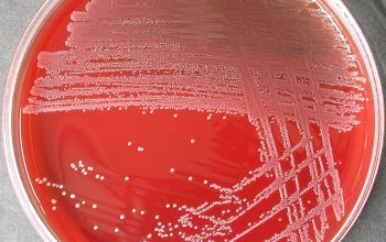 Arcanobacterium haemolyticum Blood Agar 48h culture incubated with CO2