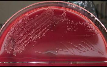Arcobacter butzleri (Aliarcobacter butzleri)  culture 
