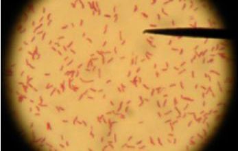 Arcobacter butzleri (Aliarcobacter butzleri) 