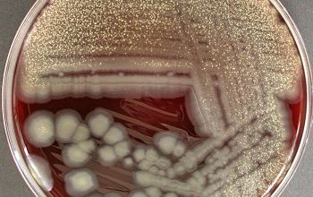 Bacillus anthracis Blood Agar 48h culture incubated with O2