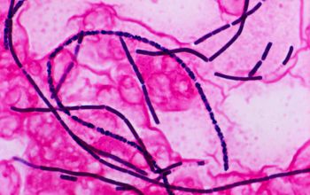 Bacillus anthracis Gram stain