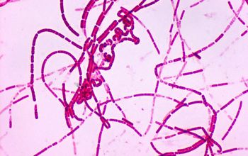 Bacillus anthracis Wirtz stain