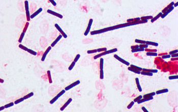 Bacillus anthracis Gram stain