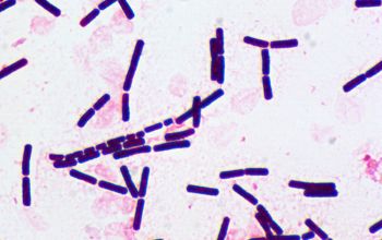 Bacillus cereus Gram stain