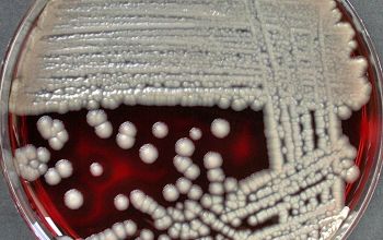 Bacillus cereus Blood Agar 24h culture incubated with O2