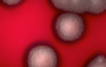 Bacillus cereus Blood Agar 24h culture incubated with O2