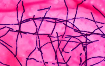 Bacillus cereus Gram stain