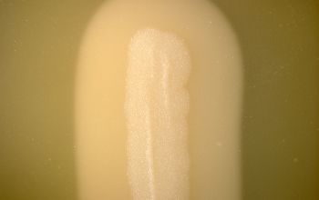 Bacillus cereus  culture incubated with O2