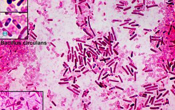 Bacillus circulans (Niallia circulans) Gram stain