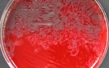 Bacillus circulans (Niallia circulans) Blood Agar 24h culture incubated with O2