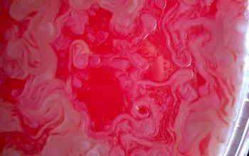 Bacillus circulans (Niallia circulans) Blood Agar 48h culture incubated with O2