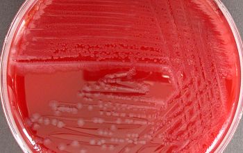 Bacillus circulans (Niallia circulans) Blood Agar 24h culture incubated with O2