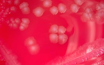 Bacillus circulans (Niallia circulans) Blood Agar 24h culture incubated with O2