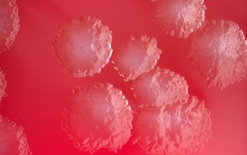 Bacillus circulans (Niallia circulans) Blood Agar 24h culture incubated with O2