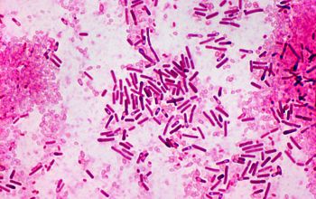 Bacillus circulans (Niallia circulans) Gram stain