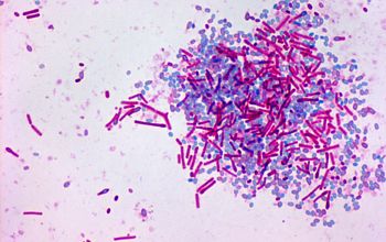 Bacillus circulans (Niallia circulans) Wirtz stain