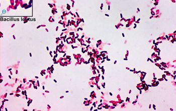 Bacillus lentus (Lederbergia lentus) Gram stain