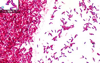 Bacillus lentus (Lederbergia lentus) Wirtz stain