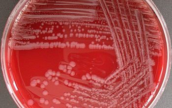 Bacillus lentus (Lederbergia lentus) Blood Agar 48h culture incubated with O2
