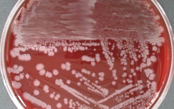 Bacillus lentus (Lederbergia lentus)  culture incubated with O2