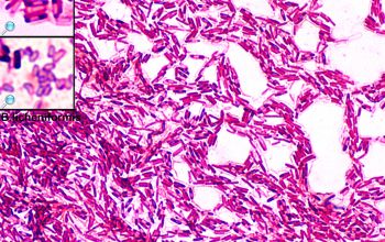 Bacillus licheniformis Gram stain