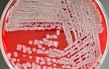 Bacillus licheniformis Blood Agar 24h culture incubated with O2