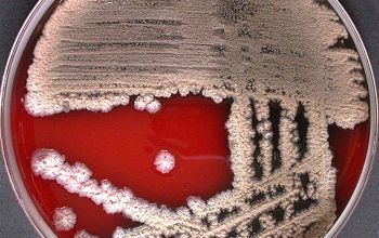 Bacillus licheniformis Blood Agar 48h culture incubated with O2