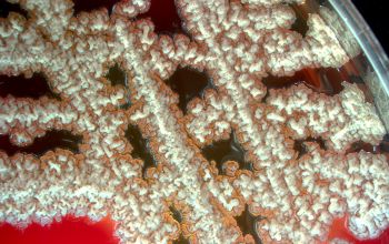 Bacillus licheniformis Blood Agar 48h culture incubated with O2