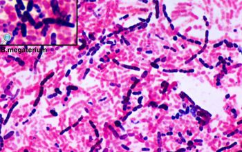Bacillus megaterium (Priestia megaterium) Gram stain