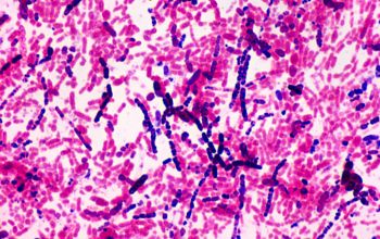 Bacillus megaterium (Priestia megaterium) Gram stain