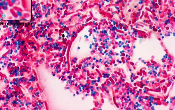 Bacillus megaterium (Priestia megaterium) Wirtz stain