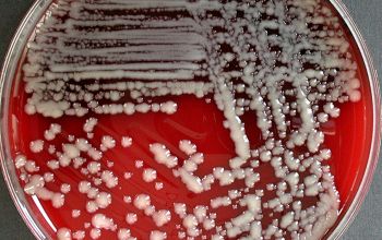 Bacillus megaterium (Priestia megaterium) Blood Agar 24h culture incubated with O2