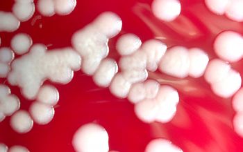 Bacillus megaterium (Priestia megaterium) Blood Agar 24h culture incubated with O2