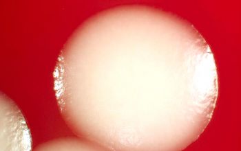 Bacillus megaterium (Priestia megaterium) Blood Agar 24h culture incubated with O2