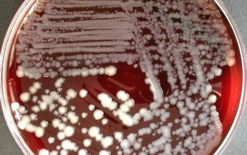 Bacillus megaterium (Priestia megaterium) Blood Agar 48h culture incubated with O2