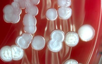 Bacillus megaterium (Priestia megaterium) Blood Agar 48h culture incubated with O2