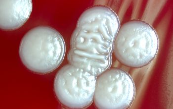 Bacillus megaterium (Priestia megaterium) Blood Agar 48h culture incubated with O2