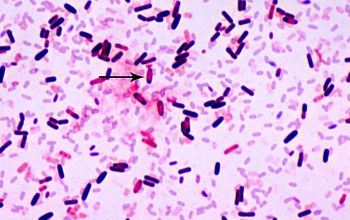 Bacillus pumilus Gram stain