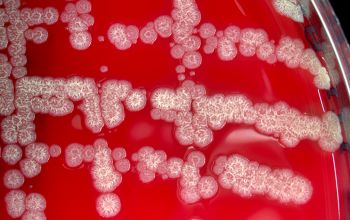 Bacillus pumilus Blood Agar 24h culture incubated with O2