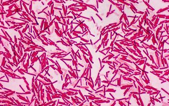 Bacillus subtilis Wirtz stain