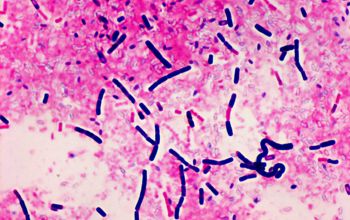 Bacillus thuringiensis Gram stain